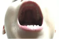 下からの上の歯