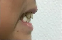 真横
